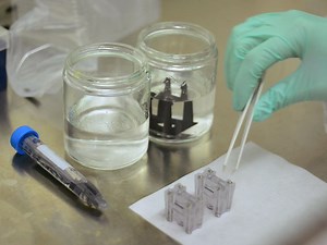 Cell Squeezing as a Robust, Microfluidic Intracellular Delivery Platform