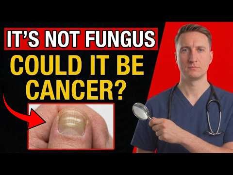 LOOK AT YOUR NAILS RIGHT NOW! 8 Signs of Deadly Disease You Keep Ignoring