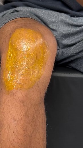 2.3M views · 21K reactions | See how to instantly eliminate knee pain without taking medication! | Top Tips | Facebook