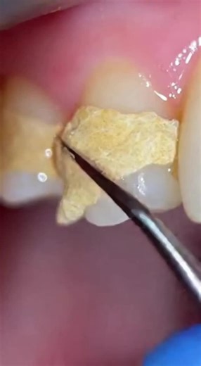 Satisfying AI ASMR Tooth Sounds