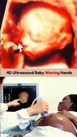 24 Weeks Baby Waving Mom on 4D Ultrasound Scan 🥰💯