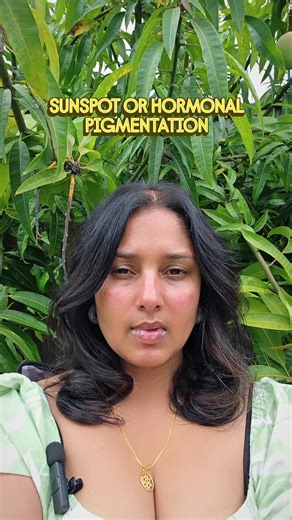 Stop Guessing, Start Treating Melasma Effectively