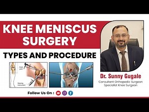 What Is Knee Meniscus Surgery | Types and Surgical Procedure | Dr Sunny Gugale