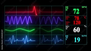 Monitoring of patient's condition, vital signs on ICU monitor in hospital. Medical ICU monitor with patient's vital signs 4k..
