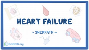 Heart failure: Nursing pathophysiology: Video, Causes, & Meaning | Osmosis