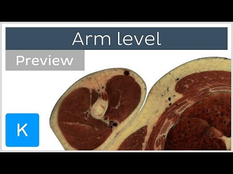 Cross sections of the upper extremity - upper arm (preview) - Human Anatomy | Kenhub
