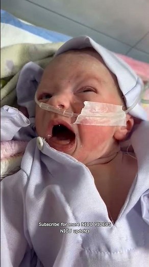 Newborn With Respiratory Distress Syndrome (RDS) – Real NICU Care #babycare #nicu