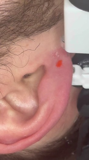 Ear Piercing ASMR Experience