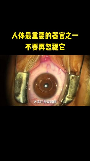 眼睛中的叶黄素到 底有何作 What is the role of lutein in the eyes? Lutein Eagle Eye Vision (60s) max Lutein Strengthened - Billberry Grape Seed Lycopene for Eye Health #treatyourself #TikTokShopSG #createtowin #Createtowin 立运行 #tiktokshopsgsale #fyp #foryou #foryoupages #foryoupageofficiall #foryou #科普知识 #科普一下 #涨知识 # 科普 #科普研究所 #眼睛 #TikTokShopSGBday #foryoupage #TikTokShopSG #好物分 #fyp #treatyourself #tiktokshopsgbday #好物分享 #luteinbenefits #叶黄素 #lutein #eye #eyes #eyehealth