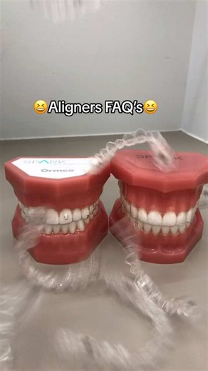 The CLEAR truth about aligners 🦷🦷🦷#smilestyleortho #smilestyleorthodontics #drt #drtselepis #aligners #spark #invisalign #clear #thechoiceisclear