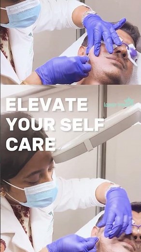 Subcision & PRP for Acne Scars | Permanent Acne Scar Treatment at LaserTreat