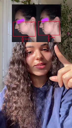 Master Mewing Techniques for a Defined Jawline