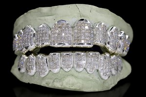 Invisible Set VVS Moissanite Grillz, Princess Cut Moissanite, Deep/perm Cut, 925 Sterling Silver, Pass Diamond Test - Etsy