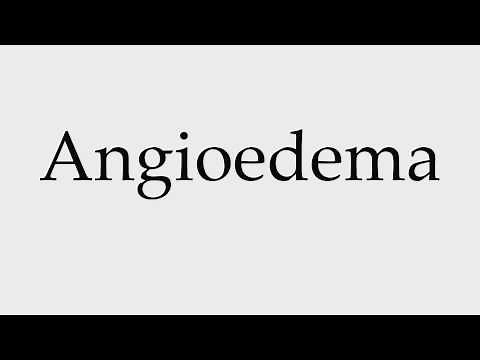 How to Pronounce Angioedema