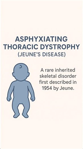 Asphyxiating Thoracic Dystrophy (Jeune’s Disease) Explained #physiotherapist