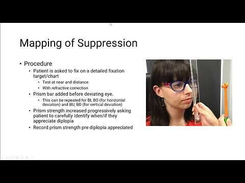Mapping Suppression