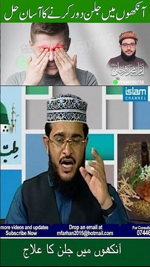 How to Stop Eye Burning Naturally | Quick Eye Relief #shorts