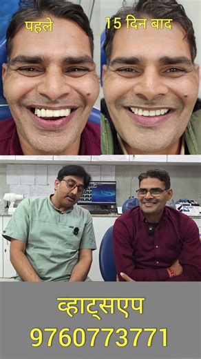 Smile makeover with implants