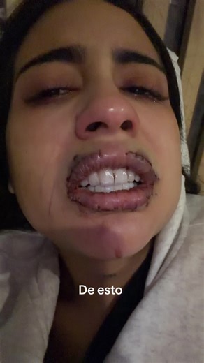 No has ido fácil pero así vamos …. 🩵en ig les cuento más acerca de mi proceso ig: Hillary.escriba