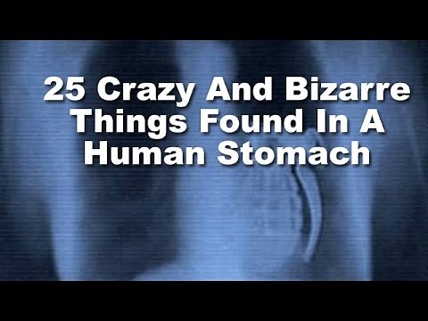 25 Crazy And Bizarre Things Found In A Human Stomach