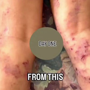 Struggling with irritated, itchy skin? Find relief with Frankie...