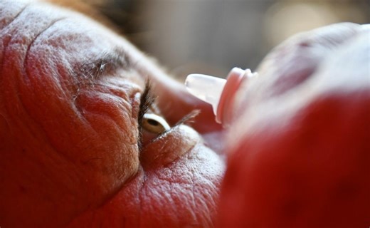 Conjuntivitis: Qué es, cuáles son sus síntomas y cómo tratar esta molesta afección ocular