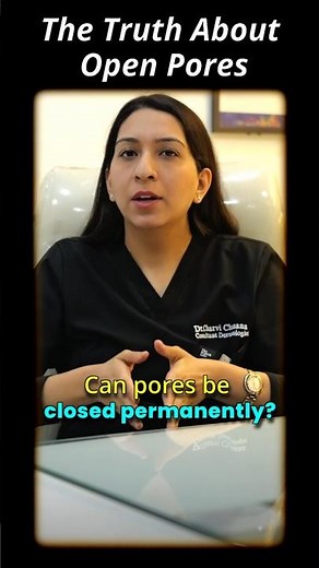 Large or visible open pores