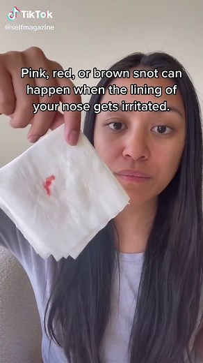 In most cases, pink, red, or brown boogers are fine. #Health #Boogers #HealthTip #LearnOnTikTok #TikTokPartner