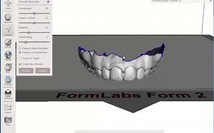 iBlender中文版插件dentisit 教程MeshMixer：如何为牙科模型添加底座Blender