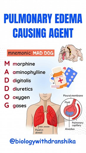 Pulmonary Edema: Common Causing Agents Explained #pulmonaryedema #causing #respiratorymedicine