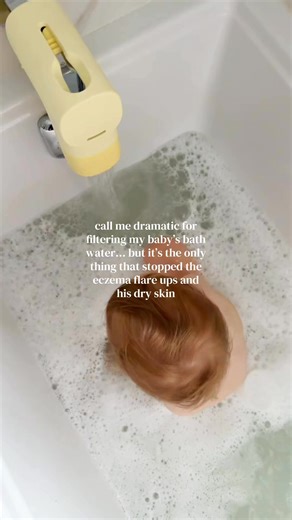 I wish this existed when my twins were little babies because one of them had eczema and extremely dry spots and nothing helped him. Our tapwater is really bad so this helps filter out all the chlorine and heavy metals and all the other junk that’s in the water. Comment FILTER for link Baby bath water filter Water filter for eczema Baby eczema bath solution Hard water and baby skin Filter bathtub water for baby Chlorine free bath water Best bath filter for babies Eczema flare up relief for babies