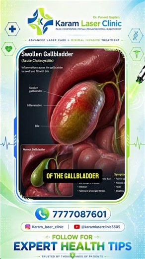 Never Ignore Abdominal Pain! It Could Be More Serious Than You Think