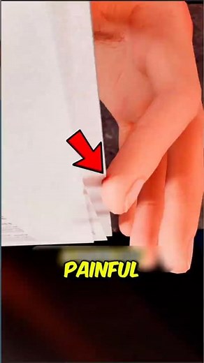 NEVER Underestimate a Paper Cut — Here's Why They Hurt So Much ‼️😱📄