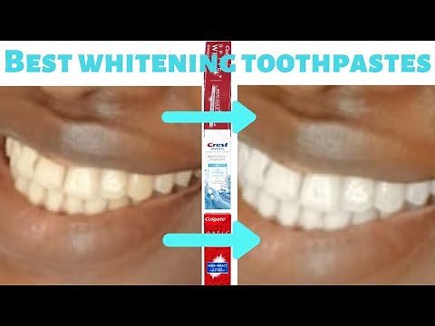 Best toothpaste for whitening; A Dentist's guide (tried and trusted)