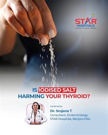 Is iodised salt really harmful for thyroid health, or is it just a common misconception? Dr Srujana T, Consultant in Endocrinology at STAR Hospitals, Banjara Hills, explains why most people do not need to fear iodised salt. Autoimmune thyroid conditions are linked to extremely high iodine intake levels that are practically impossible through normal daily salt consumption. For individuals with hypothyroidism who limit salt intake and use iodised salt appropriately, there is no added thyroid risk.