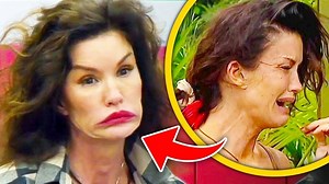 Top 10 Botched Celebrities That CRIED Over Their Plastic Surgery Fails | Landonproduction