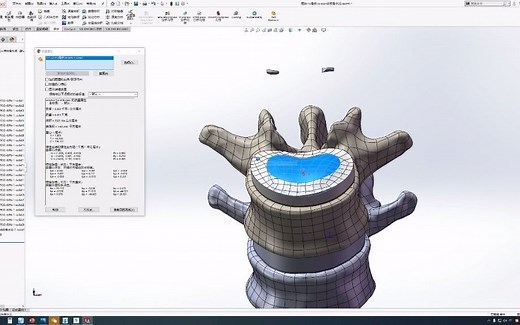 3：SolidWorks创建椎间盘、软骨和椎体间组装----脊柱生物力学