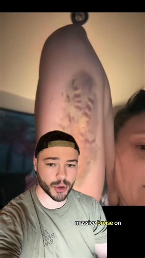 42K views · 1.1K reactions | Why You Shouldn’t Get This Birth Control? 樂 (short compilation) | IdkSterling | Facebook