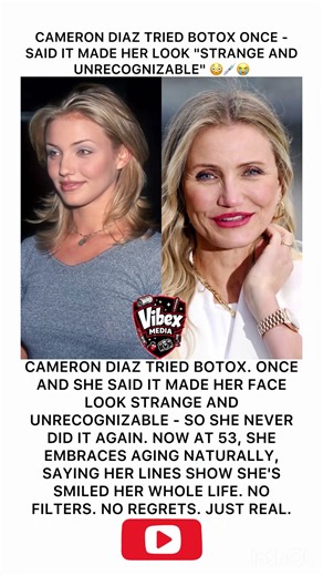 💉 Cameron Diaz Tried Botox Once – Said It Made Her Look "Strange and Unrecognizable" 😂