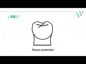GC Fuji TRIAGE Activation Technique COA