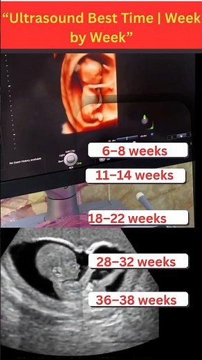 “Ultrasound Best Time | Week by Week” #ultrasound #baby #pregnant