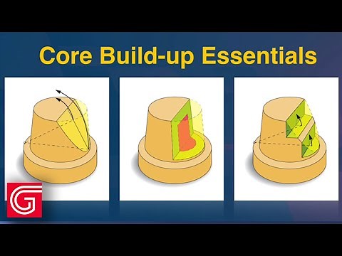 Tooth Preparation for Post and Core Dental Procedure