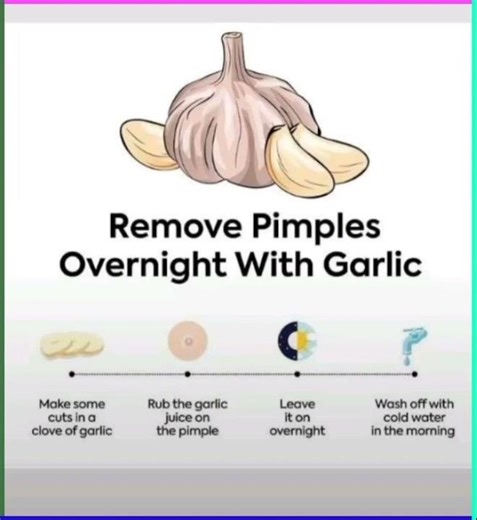 🌙 Remove Pimples Overnight with Garlic 🌙#AcneRemedy #GarlicForSkin #NaturalCare