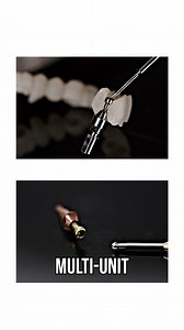 Discover how Powerball screws revolutionize dental solutions by ensuring long-lasting, high-quality results for patients. With a unique design for various materials, your patients will trust you more. Don't compromise on quality; choose Powerball for exceptional outcomes. #DentalInnovation #PowerballScrew #DentistryTips #PatientCare #DentalHealth #TrustworthyDental #LongLastingResults #DentalProducts #QualityDentistry #DentalSolutions | Smile Syllabus Training Institute