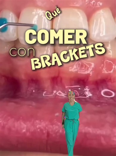 Qué comer con brackets: ranking de alimentos fáciles y sin dolor