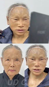 585K views · 1.1K reactions | Se estiró la piel al extremo #virals #reels #reelsviralシ | Lo Más Popular | Facebook