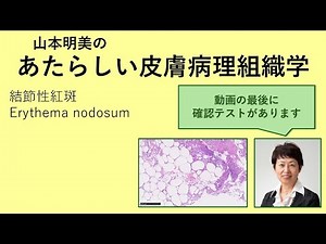 あたらしい皮膚病理組織学 結節性紅斑 erythema nodosum
