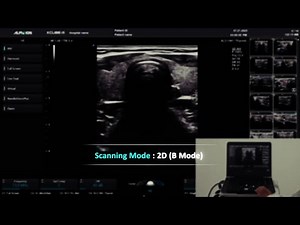 X CUBE i9 Tutorial: 2D Mode(Image Optimization, Measurement)