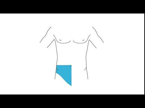 How to perform an ultrasound guided transversus abdominis plane (TAP) block