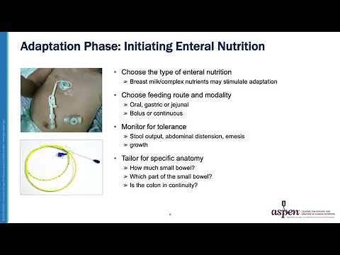 PIF - Prevention and Treatment of Malnutrition: Initial Management Strategies